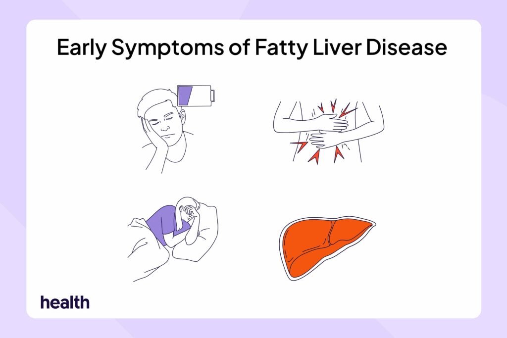Could Your Fatigue Be From Fatty Liver Disease? Plus, 4 Other Early Symptoms
