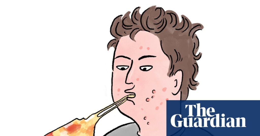Is it true that … eating greasy food causes spots? | Health & wellbeing