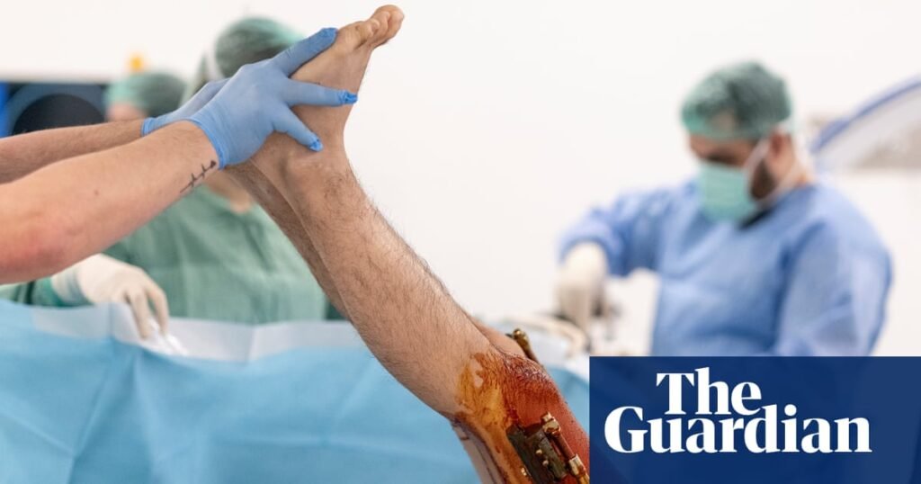 ‘Being short is a curse’: the men paying thousands to get their legs broken – and lengthened | Life and style