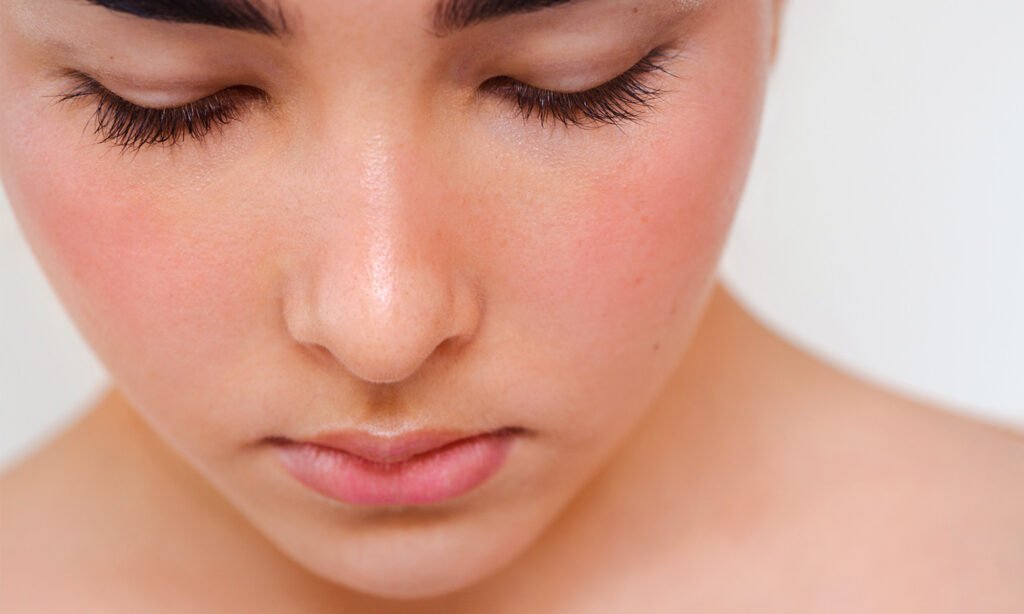 The Link Between Gut Health & Rosacea, From An Integrative Derm The Link Between Gut Health & Rosacea, From An Integrative Derm