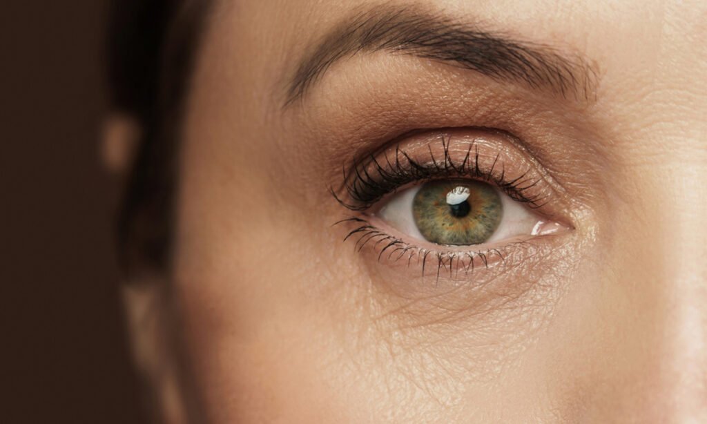 What Your Under-Eye Wrinkles Are Telling You (And How To Smooth Them)