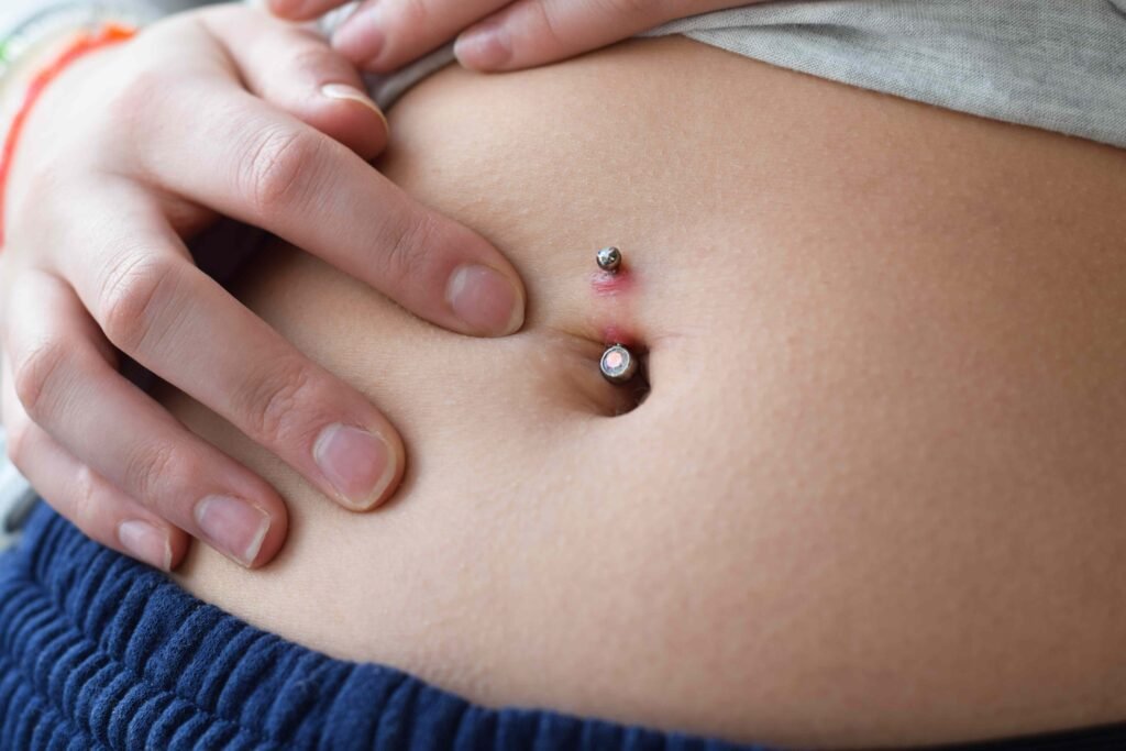 Can a Belly Button Infection Be Life-Threatening? 7 Warning Signs You Shouldn't Ignore