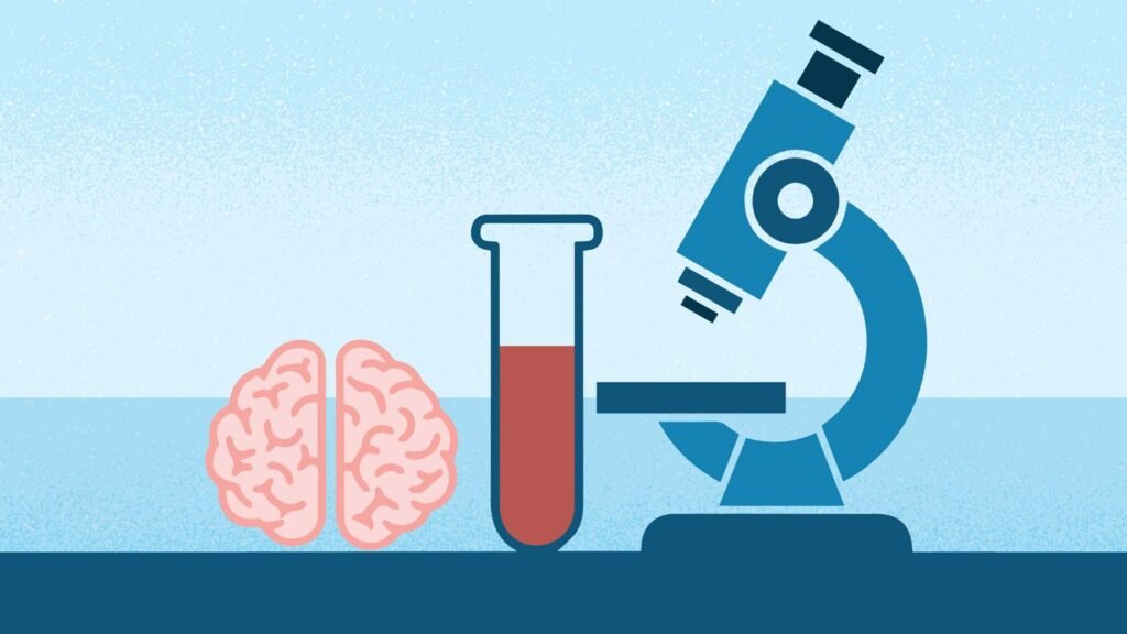 Elecsys Blood Test for Alzheimer’s Gets FDA Clearance New Blood Test to Rule Out Alzheimer’s Gets FDA Clearance