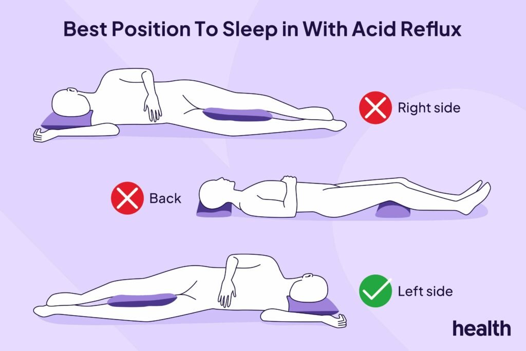 What Sleeping on Your Left Side Does for Heartburn Relief What Sleeping on Your Left Side Does for Heartburn Relief