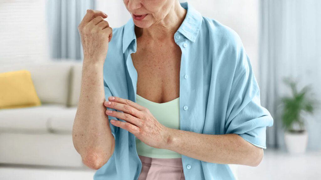 Rashes That Look Like Psoriasis woman looking at a rash on her elbow
