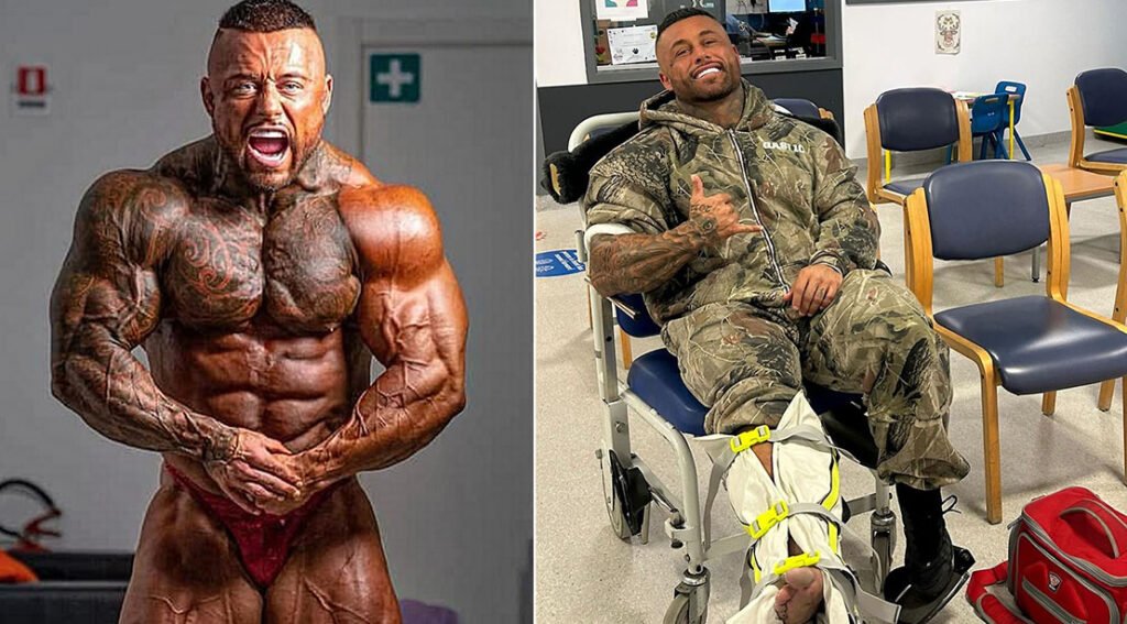 Rob Taylor Injury Update: The ‘Barnsley Pitbull’ Remains Positive After Devastating Fall on Ice Rob Taylor Injury Update: The 'Barnsley Pitbull' Remains Positive After Devastating Fall on Ice