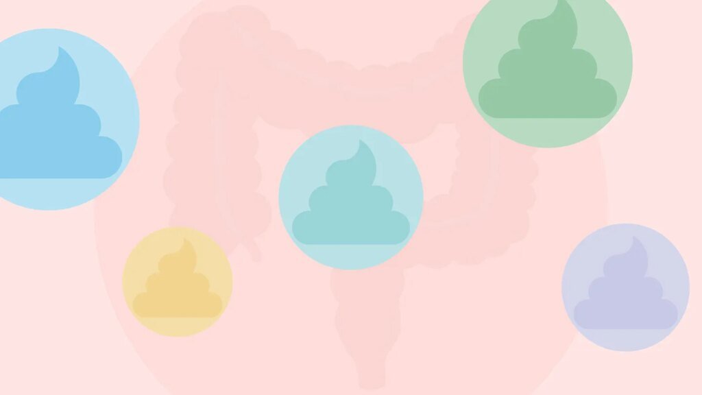 Stool Changes That Might Signal Colon Cancer Weird-Looking Stools: How Your Poop Can Signal Colon Cancer