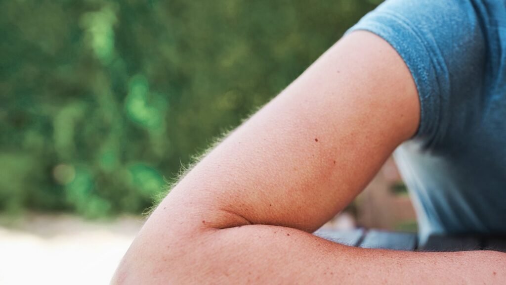 Why We Get Goosebumps