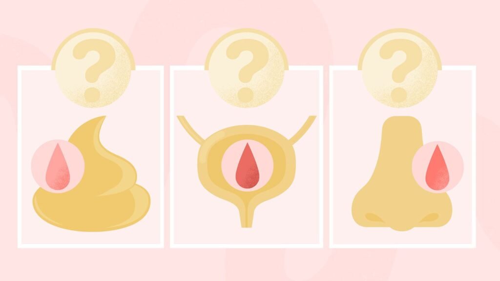 Is This Weird Bleeding a Sign of Cancer?