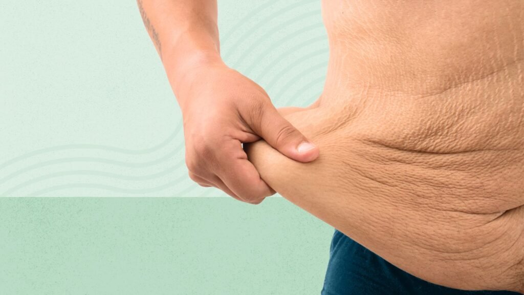 Weight Loss and Excess Skin: 7 Things to Know 7 Things No One Tells You About Weight Loss and Excess Skin