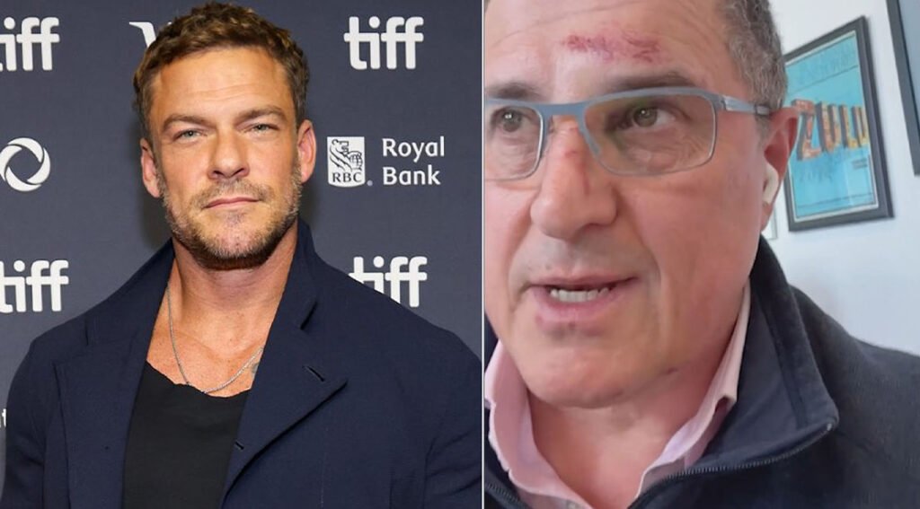 'Reacher' Star Alan Ritchson Neighborhood Fight Goes Viral: What Happened ?