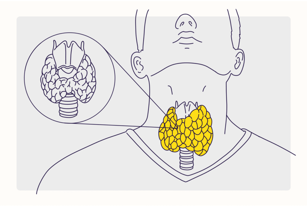 Symptoms, Causes, Treatment, & More
