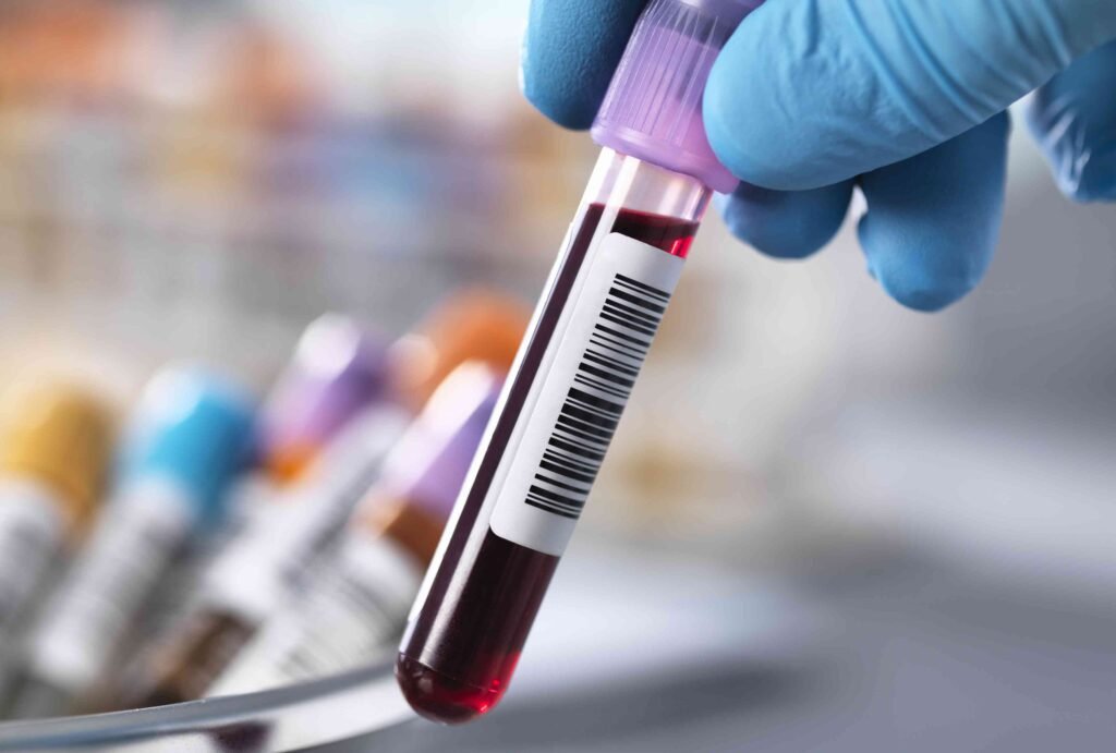 Thrombocytopenia (Low Platelet Count): Symptoms and Treatment