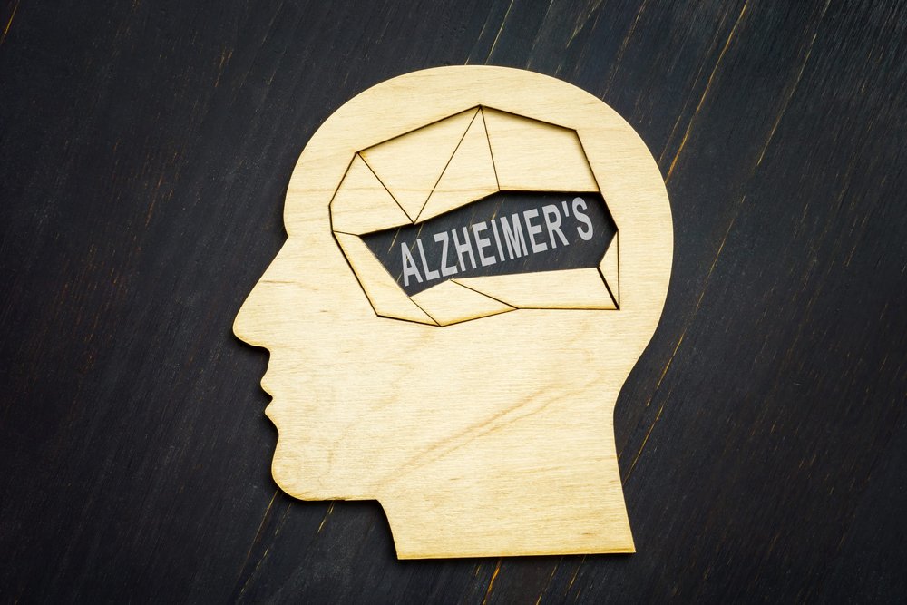 Industry Criticizes Study on Glucosamine Supplements and Alzheimer’s Disease Industry Criticizes Study on Glucosamine Supplements and Alzheimer’s Disease