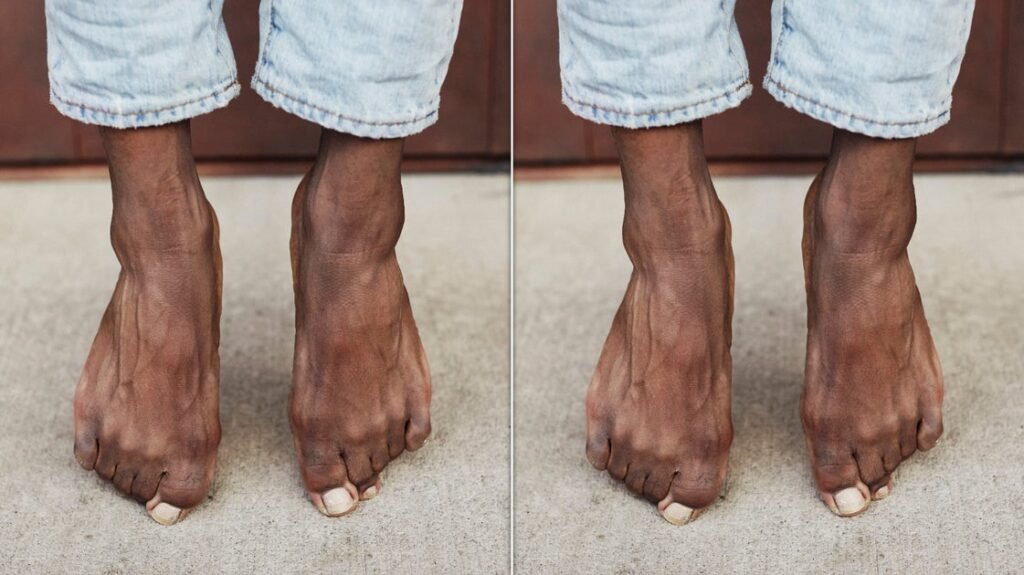 What Hair On Your Toes Says About Your Health, According To Doctors